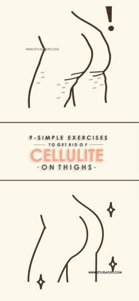 Esercizi per liberarsi della cellulite sulle cosce