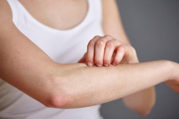 מה עוזר נגד תסמיני עור מגרד