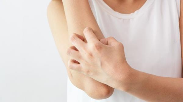 מה עוזר נגד עור מגרד לטפל מגרד