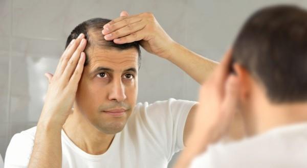 גורמים לנשירת שיער אצל גברים