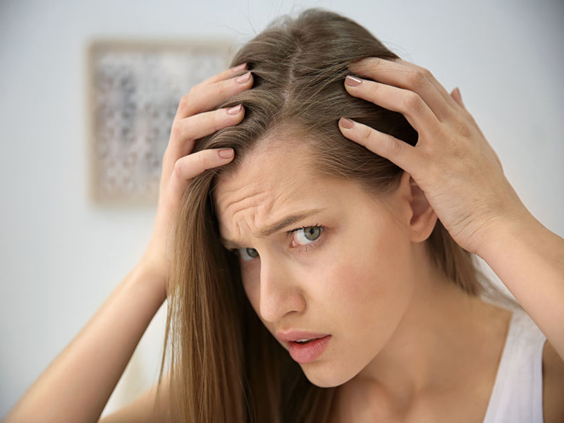 Cómo tratar la calvicie del cabello en casa